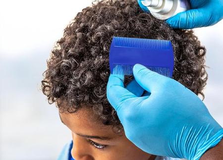 Lice Comb and Flea Comb Set