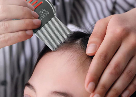 Terminator Lice Comb - Professional Stainless Steel Comb for Head Lice Treatment