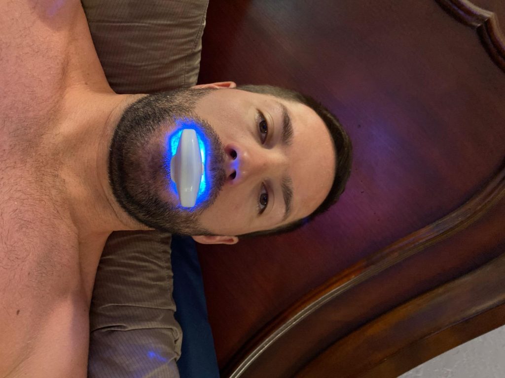 Auraglow Teeth Whitening Kit with LED Accelerator Light