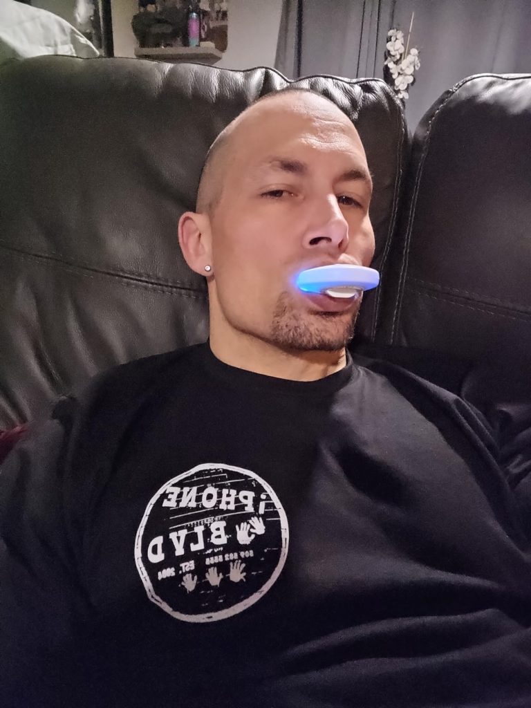 MySmile Teeth Whitening Kit with LED Light