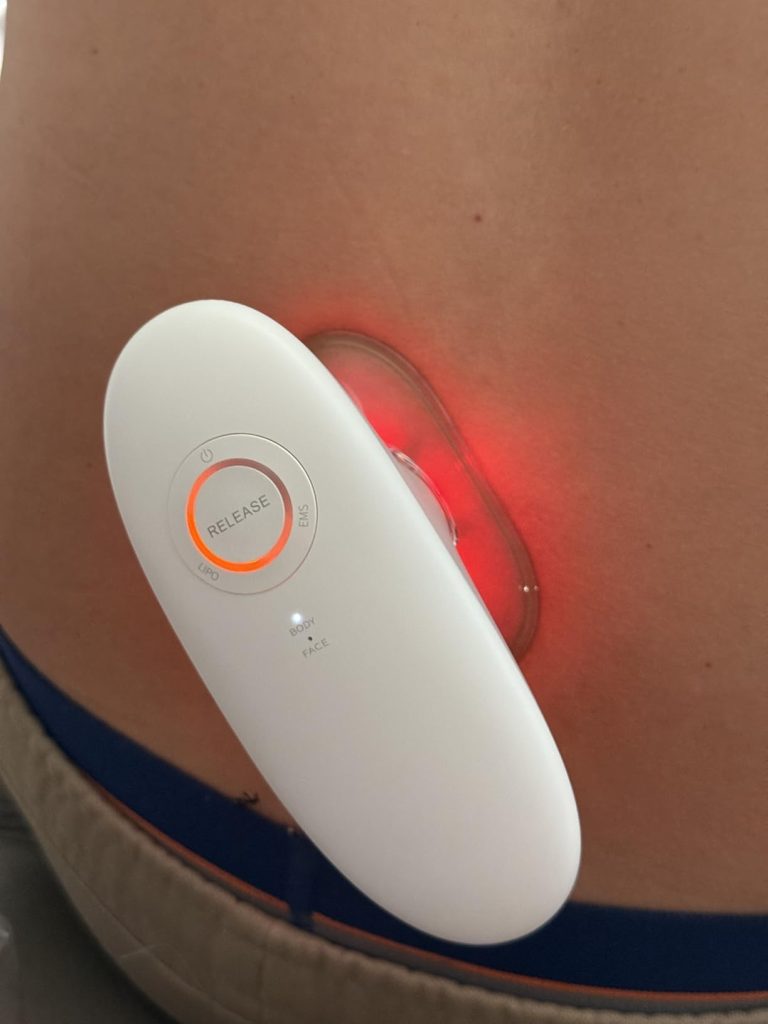 Ciyada 3-in-1 Electric Cellulite Massager and Body Sculpting Machine